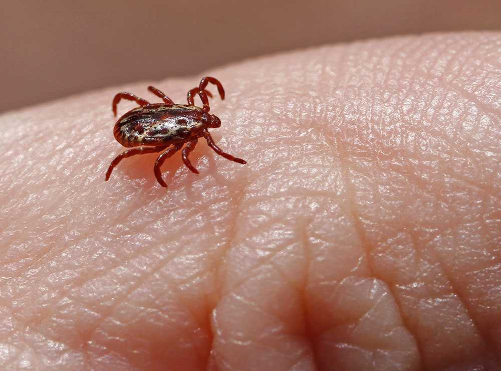 Rocky Mountain Spotted Fever